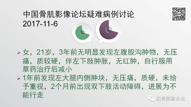 【病例】骨淋巴瘤5例影像讨论 【病例】骨淋巴瘤5例影像讨论