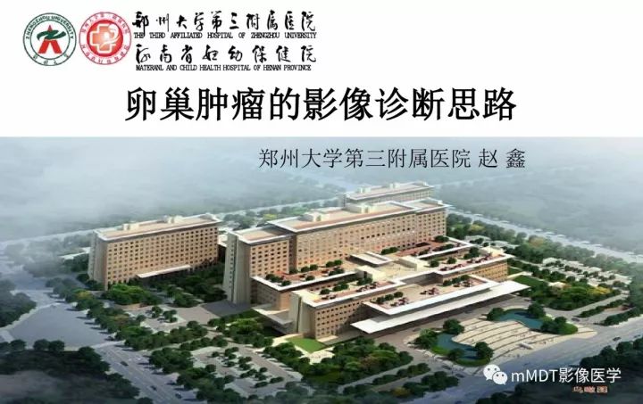 【PPT】卵巢肿瘤的影像诊断思路