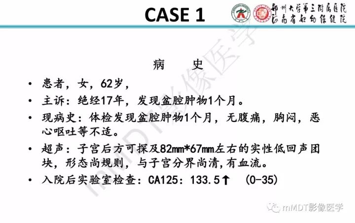 【PPT】卵巢肿瘤的影像诊断思路