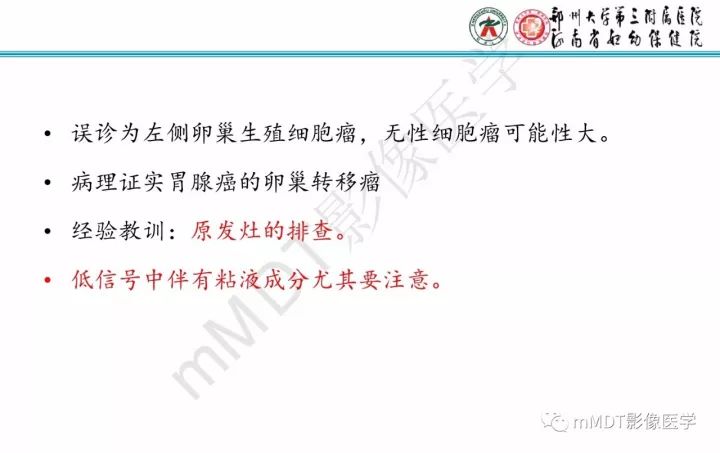 【PPT】卵巢肿瘤的影像诊断思路