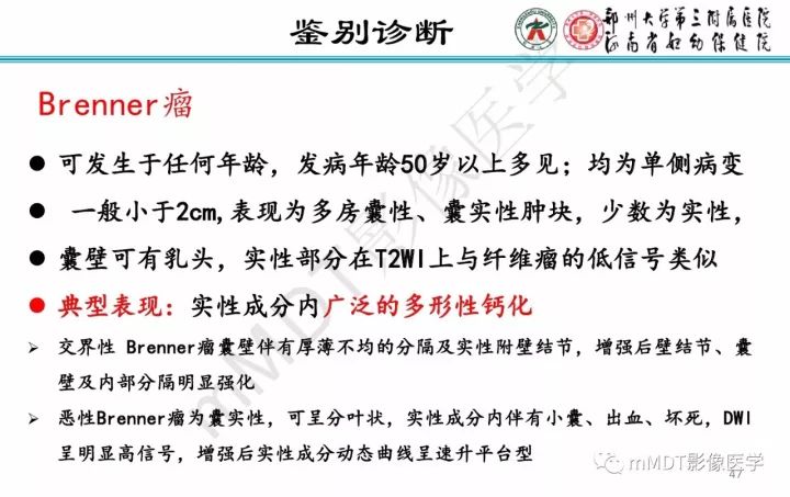 【PPT】卵巢肿瘤的影像诊断思路