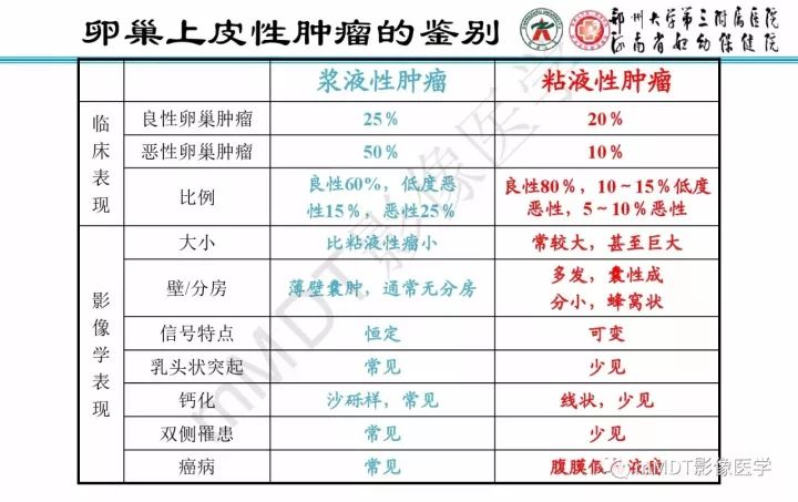 【PPT】卵巢肿瘤的影像诊断思路