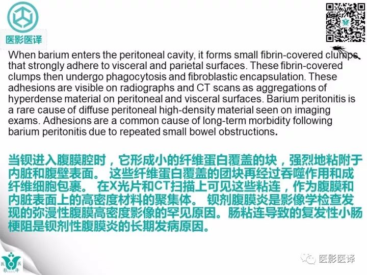 【病例】钡剂性腹膜炎1例X线CT