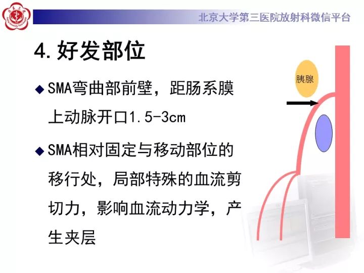 【病例】自发性肠系膜上动脉夹层1例CT