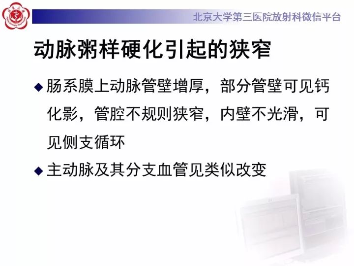 【病例】自发性肠系膜上动脉夹层1例CT