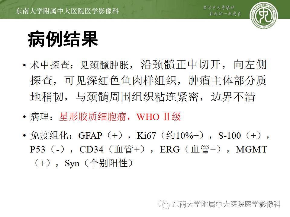 【病例】髓内星形胶质细胞瘤1例MR