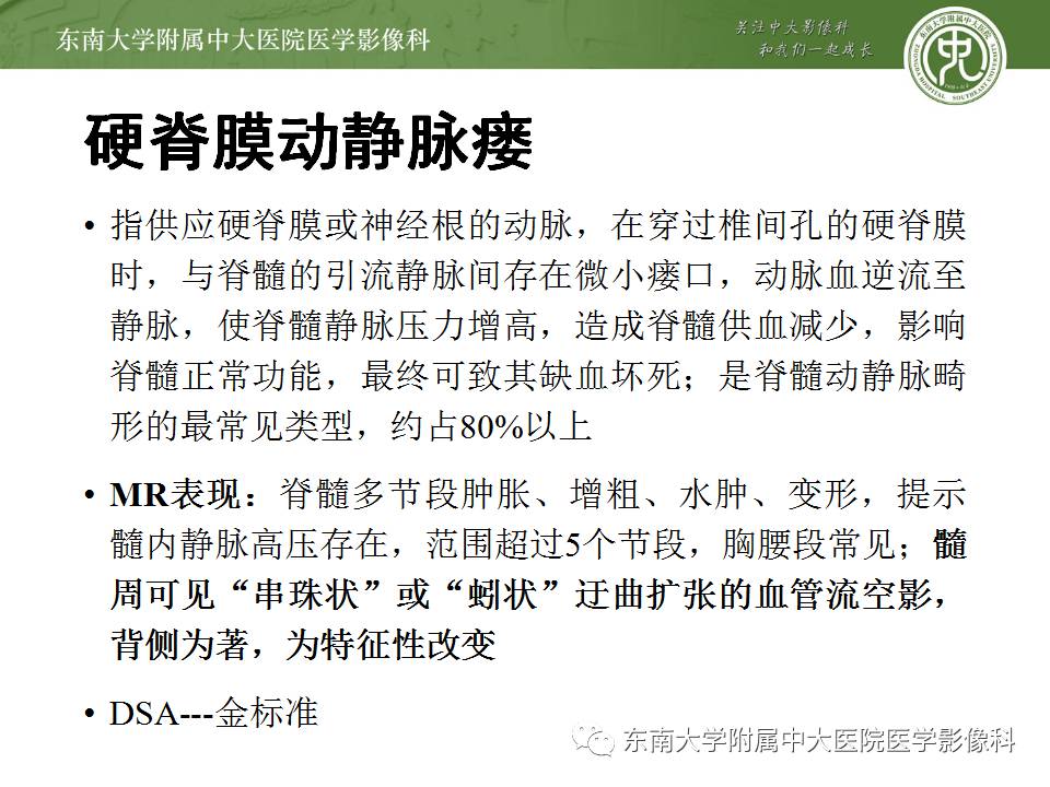 【病例】髓内星形胶质细胞瘤1例MR