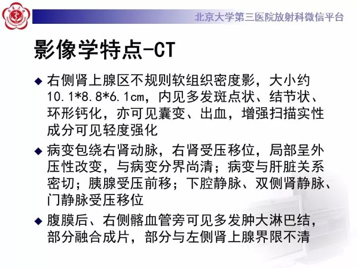 【病例】肾上腺神经母细胞瘤1例CT影像表现