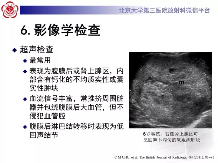 【病例】肾上腺神经母细胞瘤1例CT影像表现