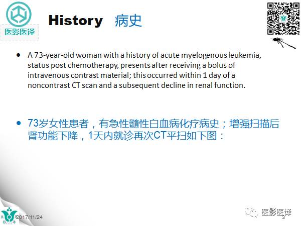 【病例】膀胱反转液平—尿液与对比剂液平反转1例CT