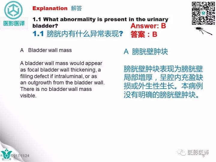 【病例】膀胱反转液平—尿液与对比剂液平反转1例CT