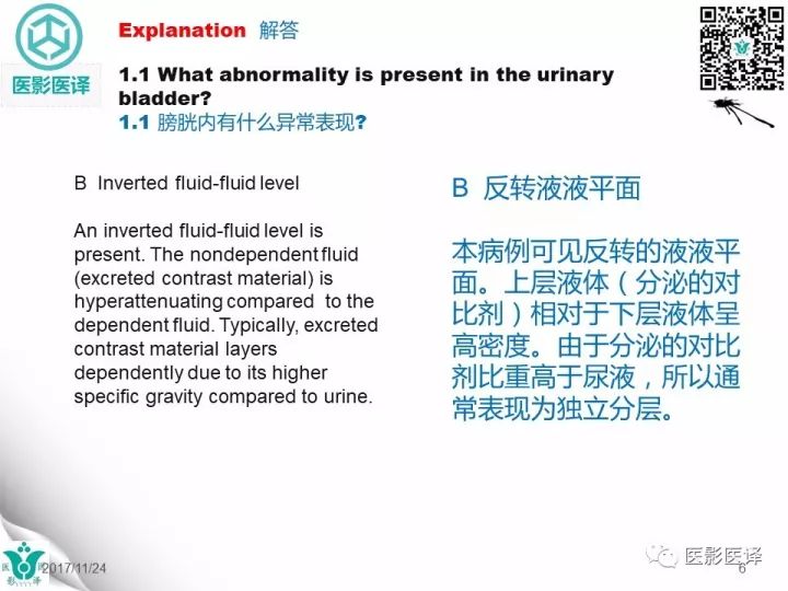 【病例】膀胱反转液平—尿液与对比剂液平反转1例CT