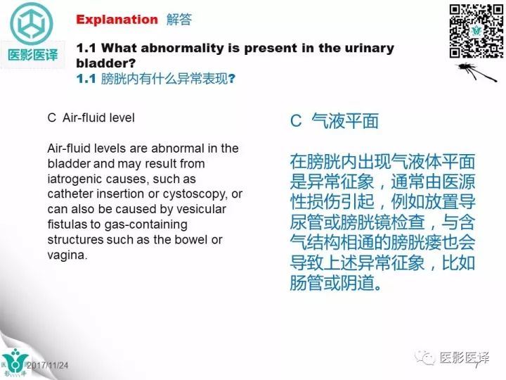 【病例】膀胱反转液平—尿液与对比剂液平反转1例CT