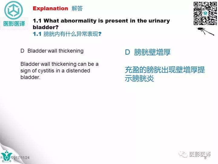 【病例】膀胱反转液平—尿液与对比剂液平反转1例CT