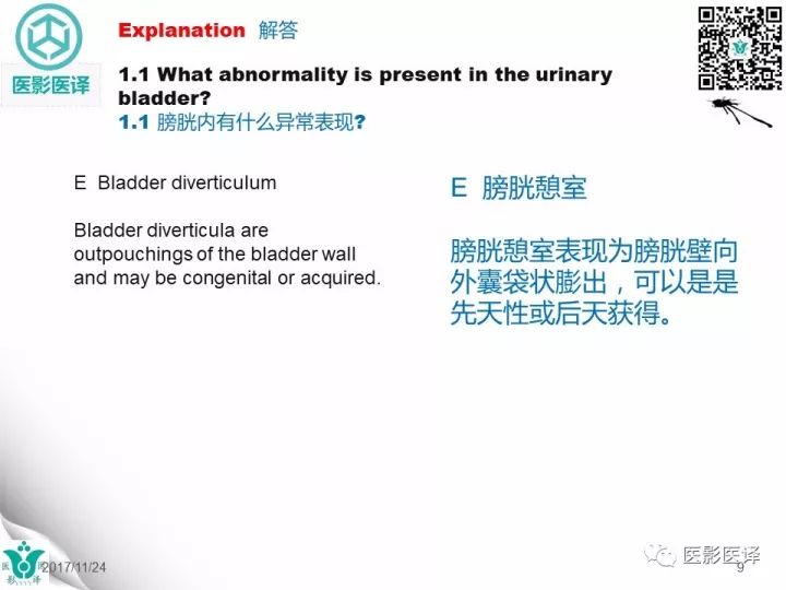 【病例】膀胱反转液平—尿液与对比剂液平反转1例CT