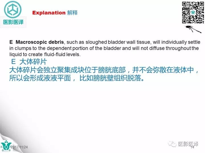 【病例】膀胱反转液平—尿液与对比剂液平反转1例CT