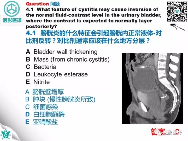 【病例】膀胱反转液平—尿液与对比剂液平反转1例CT