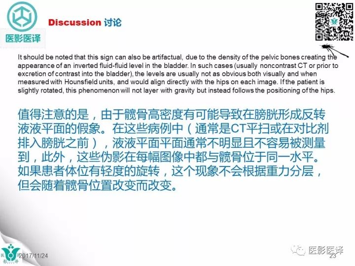 【病例】膀胱反转液平—尿液与对比剂液平反转1例CT