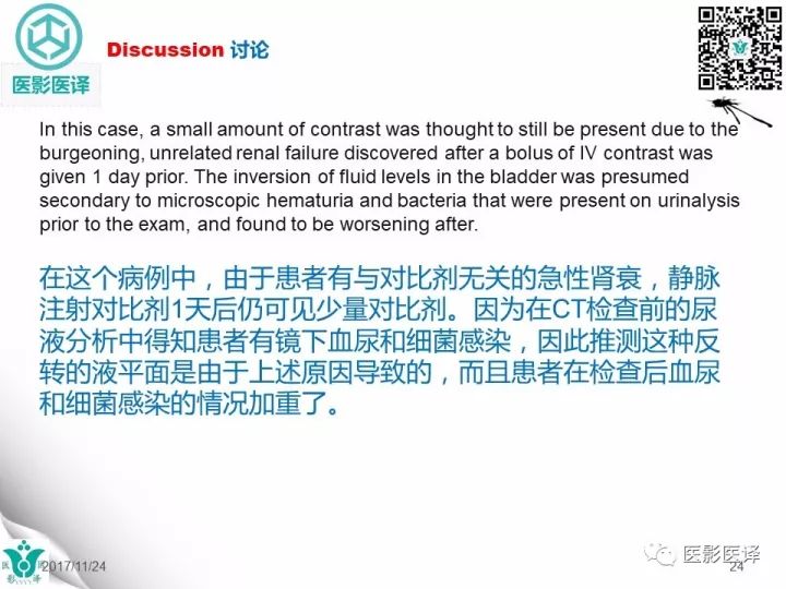 【病例】膀胱反转液平—尿液与对比剂液平反转1例CT
