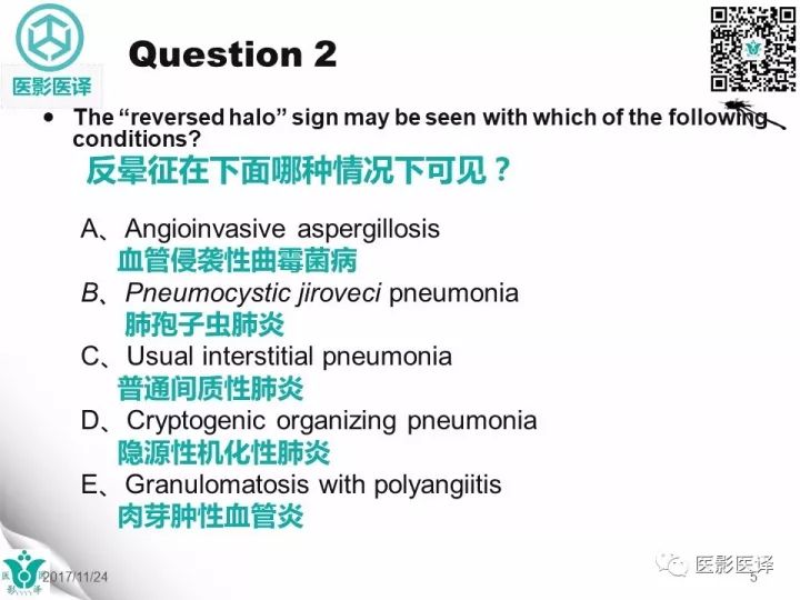 【病例】肺孢子菌肺炎1例CT影像表现