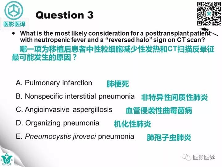 【病例】肺孢子菌肺炎1例CT影像表现