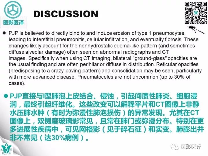 【病例】肺孢子菌肺炎1例CT影像表现