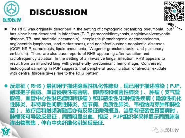 【病例】肺孢子菌肺炎1例CT影像表现