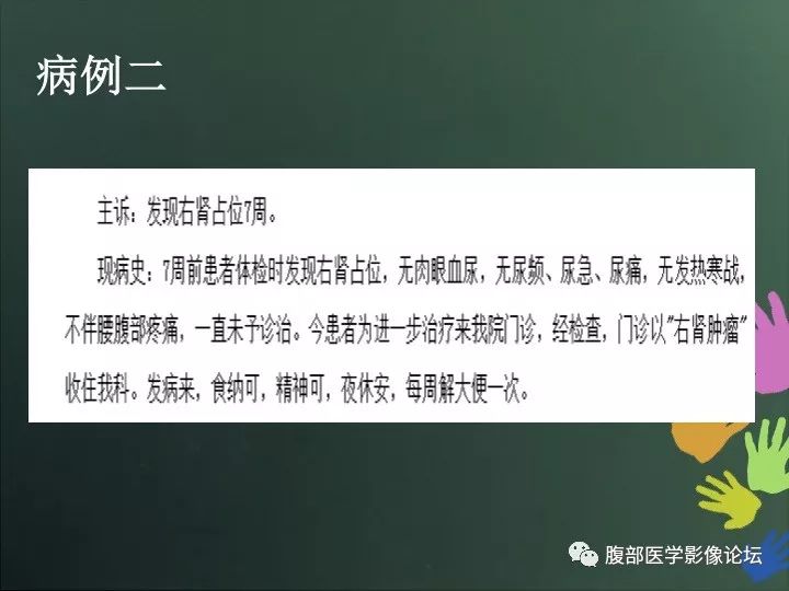 【病例】右肾透明细胞癌的不典型表现1例CT