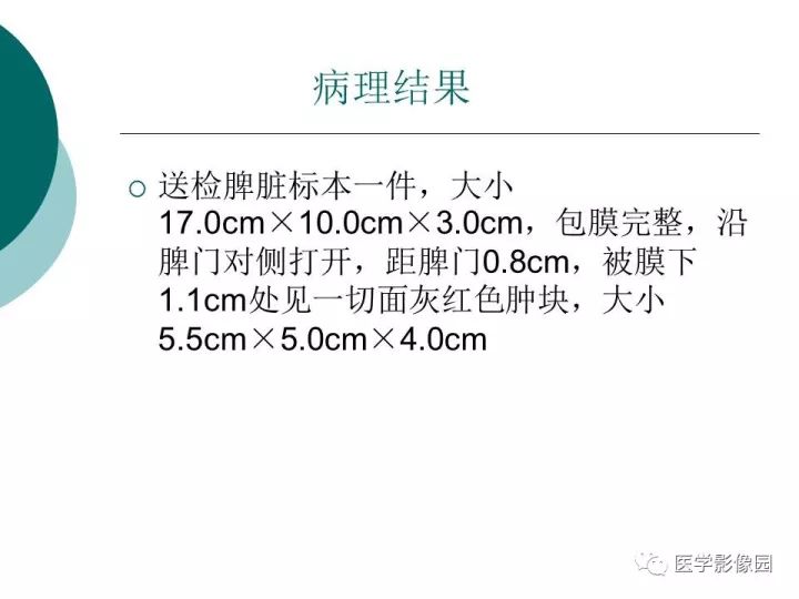 【病例】脾脏错构瘤1例CT影像表现