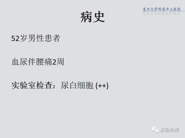 【病例】肾脏炎性假瘤1例CT