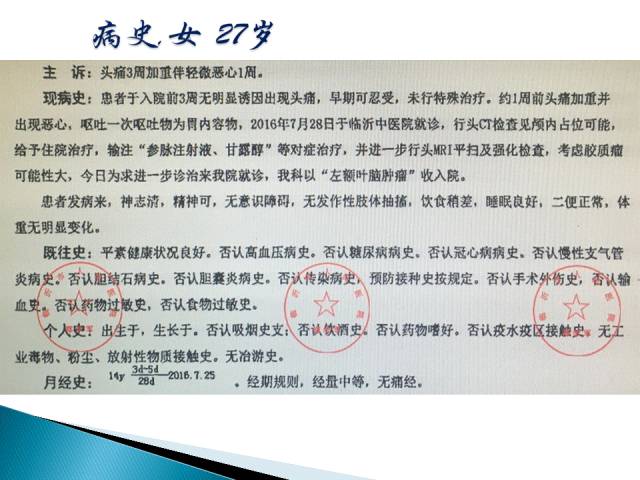 【病例】胶质母细胞瘤1例MR