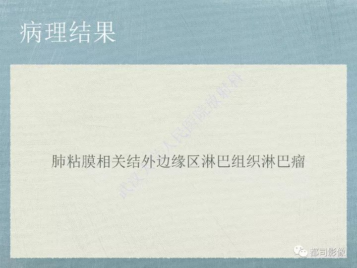 【PPT】原发性肺淋巴瘤影像诊断