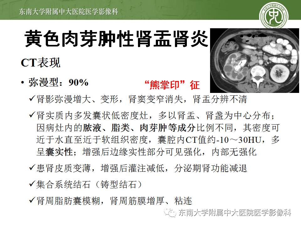 【病例】肾脏感染性病变2例CT影像诊断
