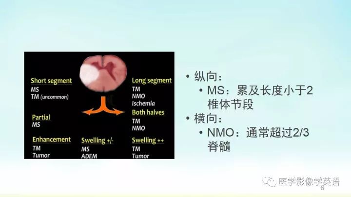 【PPT】脊髓病例