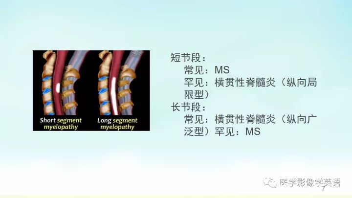 【PPT】脊髓病例
