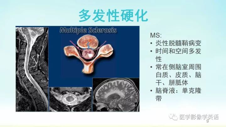 【PPT】脊髓病例