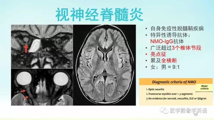 【PPT】脊髓病例