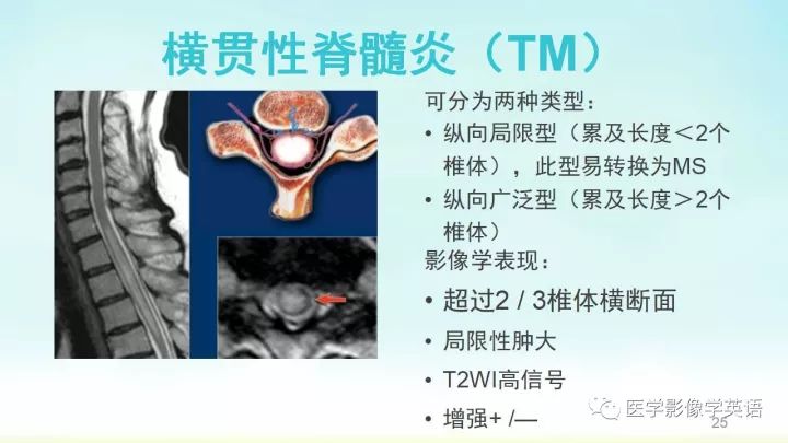 【PPT】脊髓病例