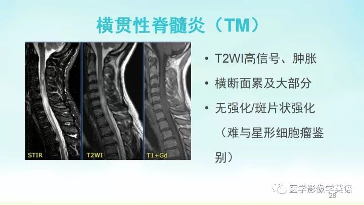 【PPT】脊髓病例