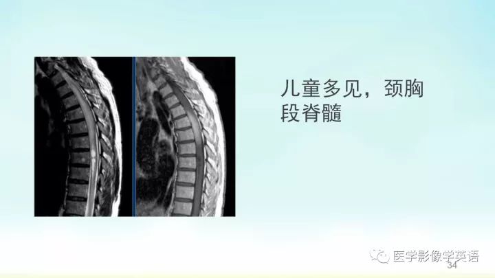 【PPT】脊髓病例