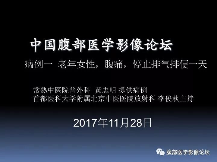 【病例】降乙结肠憩室病并憩室炎1例CT影像表现 【病例】降乙结肠憩室病并憩室炎1例CT影像表现