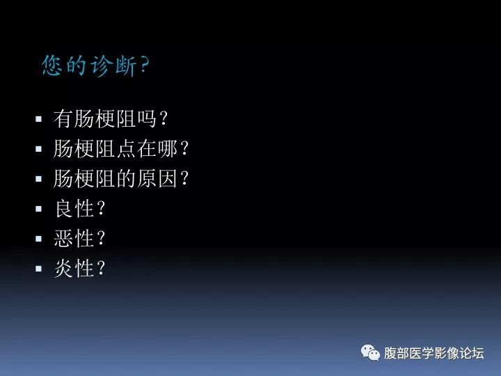 【病例】降乙结肠憩室病并憩室炎1例CT影像表现 【病例】降乙结肠憩室病并憩室炎1例CT影像表现