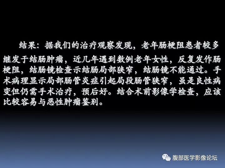 【病例】降乙结肠憩室病并憩室炎1例CT影像表现 【病例】降乙结肠憩室病并憩室炎1例CT影像表现
