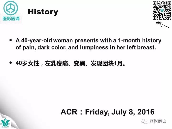 【病例】乳腺癌伴颅底转移至颈动脉管1例PET/CT