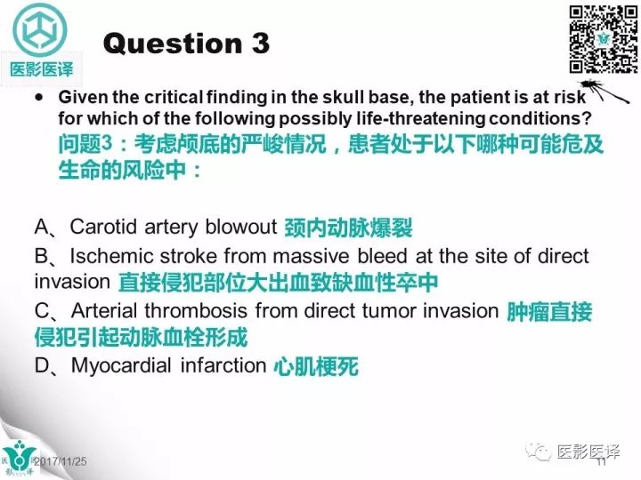 【病例】乳腺癌伴颅底转移至颈动脉管1例PET/CT