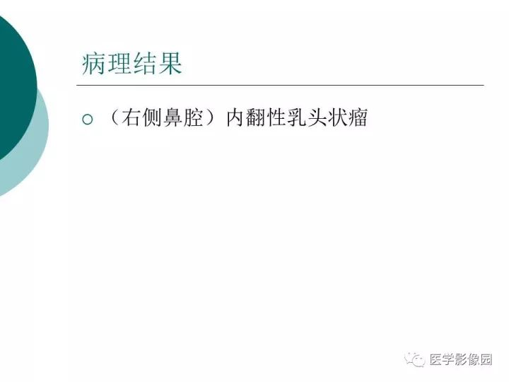 【病例】容易误诊为鼻息肉的
