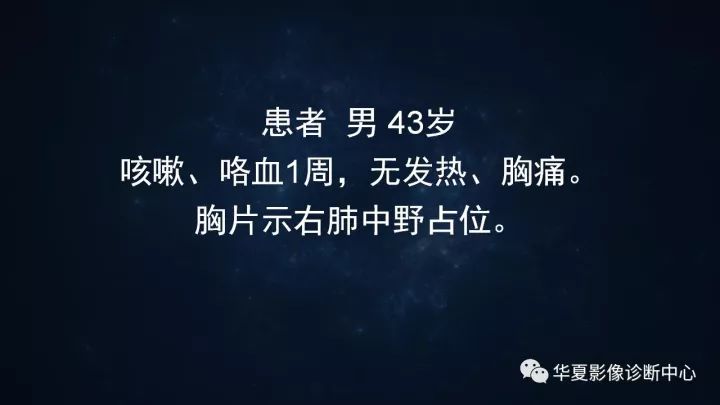 【病例】机化性肺炎1例CT影像表现