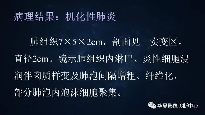 【病例】机化性肺炎1例CT影像表现