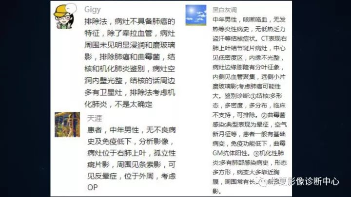 【病例】机化性肺炎1例CT影像表现