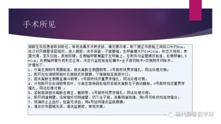 【病例】卵巢囊性腺纤维瘤1例CT及MR影像表现